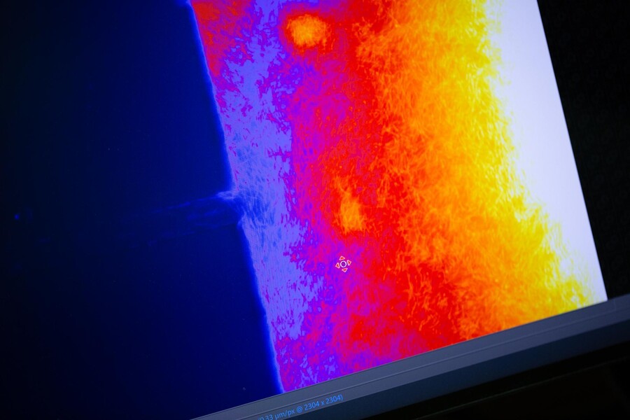 Microscopic fluorescent imaging of bacterial invasion in a nanofabricated microstructure.