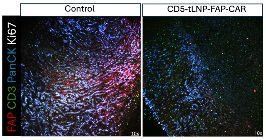 In vivo FAP-CAR T cells deplete tumor associated FAP+ fibroblasts and enhance T-cell infiltration FAP-CAR-tLNPs treated group when compared to control (PBS) group. 