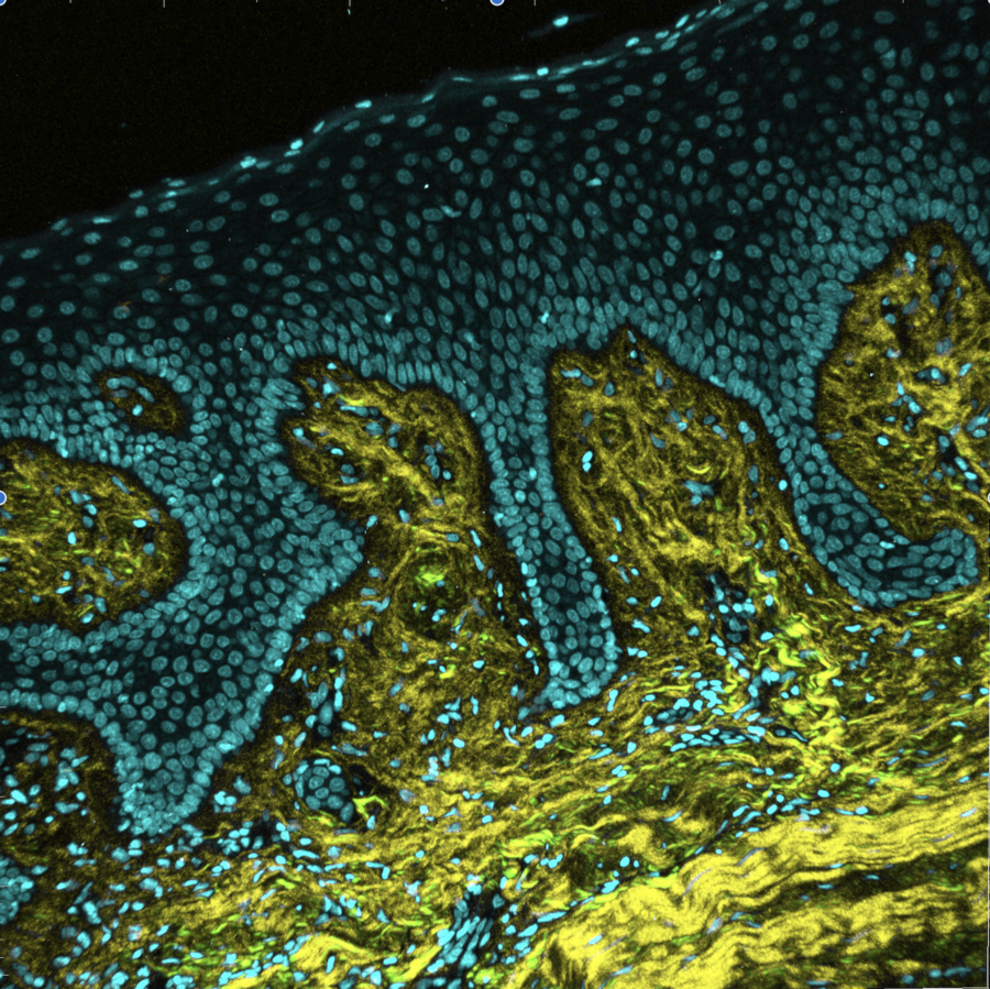 A section of healthy human gum tissue&nbsp;captured using an imaging technique called Second Harmonic Generation microscopy. In this sample, collagen fibers (shown in yellow), which give healthy gums their firm, resilient stiffness, are dense and well-organized—acting as a supportive scaffold for the surrounding cells (shown in teal).