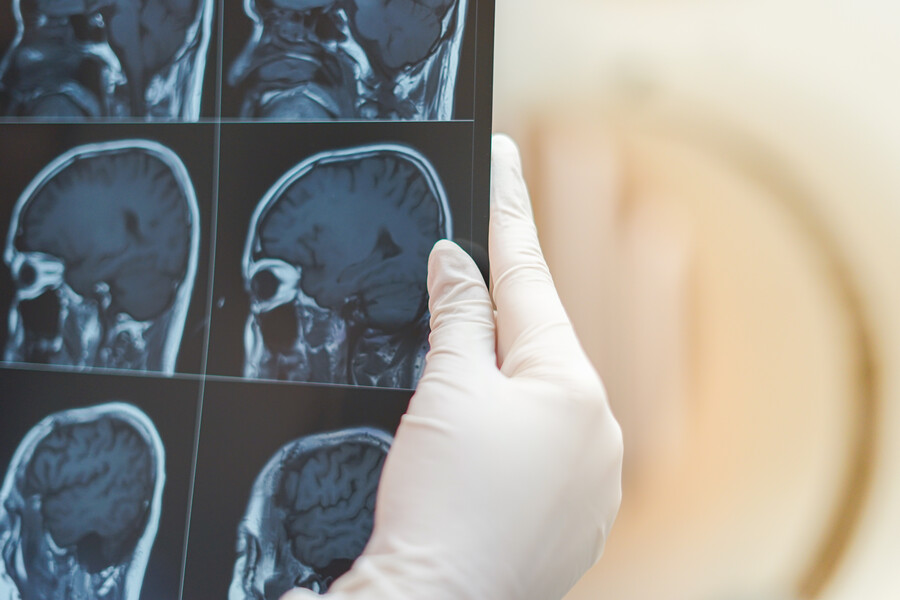  Gloved hand holding a scan of four brains