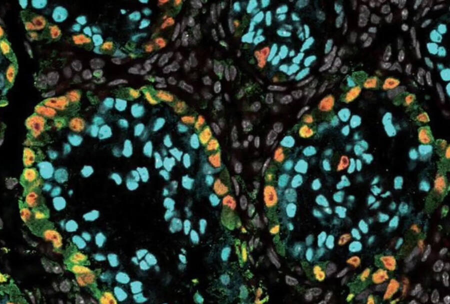 Microscopic Spermatogonia.