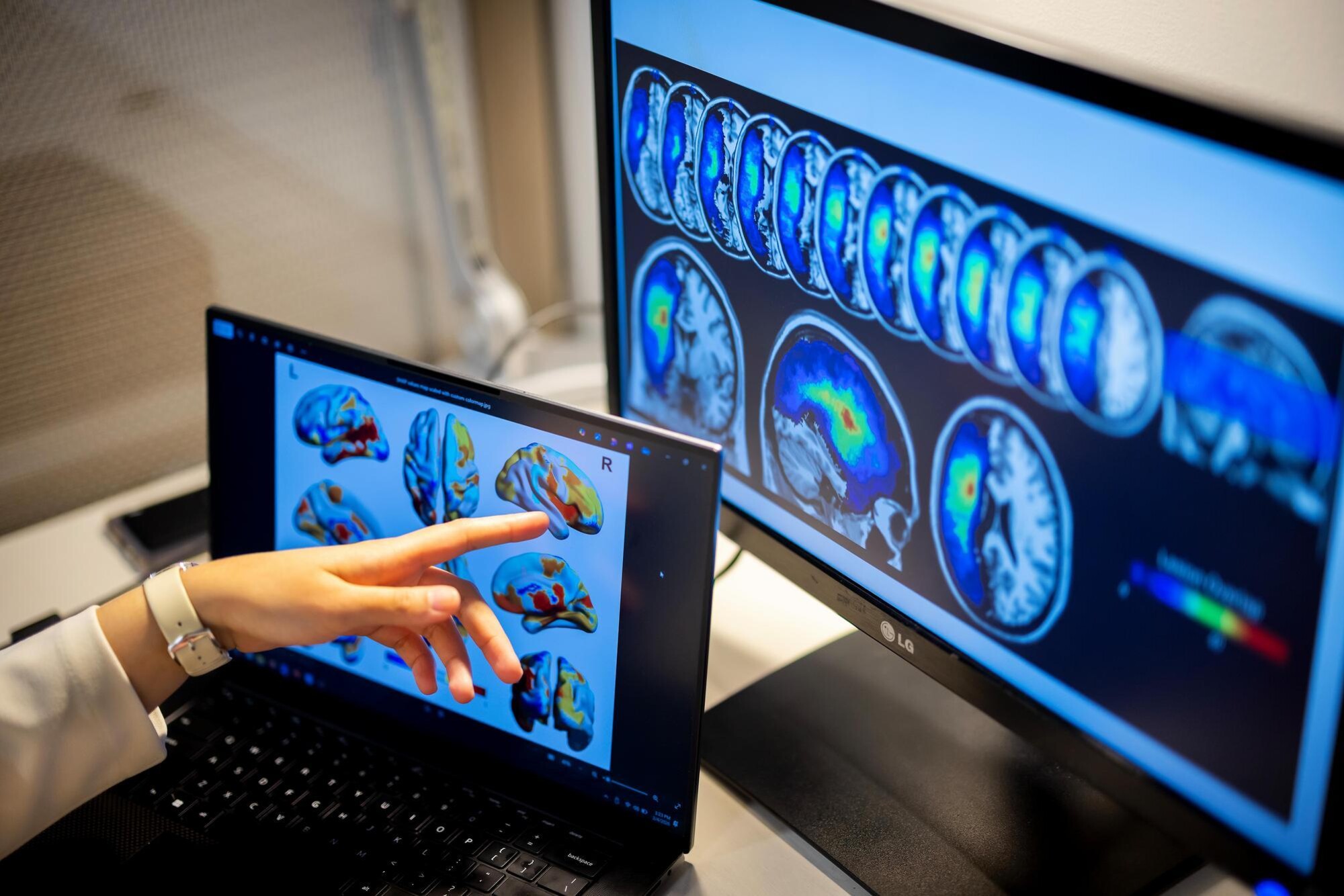 Shreya Parchure's hand is pointing to brain scan imagining and clinical research data on two computers in the Laboratory for Cognition and Neural Stimulation at the Goddard Laboratory.