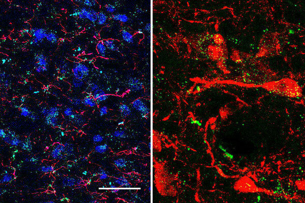 Research from Penn’s Heath Schmidt revealed that drugs already approved by the FDA to treat diabetes and obesity may reduce cocaine relapse and help addicted people break the habit