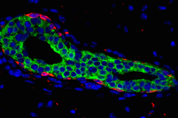 Chakrabarti.mammary gland.2018