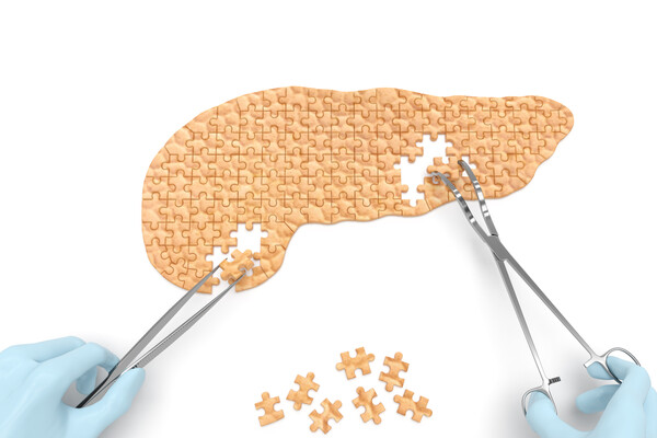 Surgeon’s hands put together a puzzle depicting a pancreas with surgical tools.