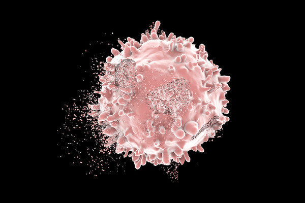 leukemic_cell