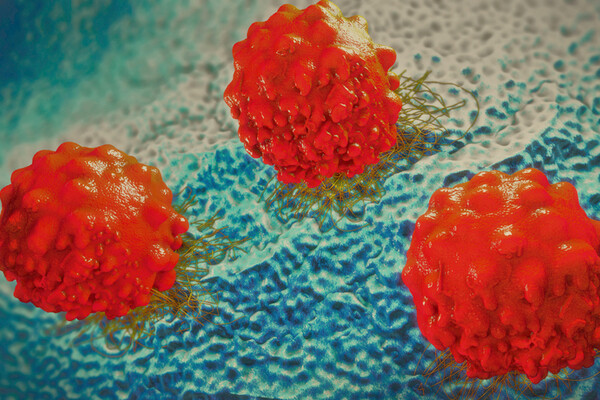 3-d illustration of cancer cells