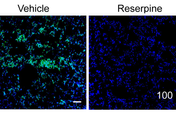 Two square panels, the left labeled "vehicle" and the right labeled "resperine." The vehicle panel has both blue and green dots and markings throughout, while the resperine panel has only blue markings.