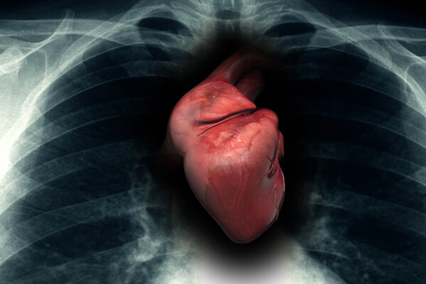 illustration of heart using x-ray imagery