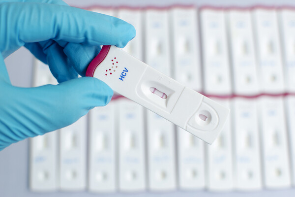 Gloved hand holding a positive Hep C test stick