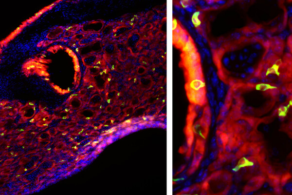 Microscopic images of fluorescent cells show up green against a red and blue background. The green glowing cells are elongated in shape.