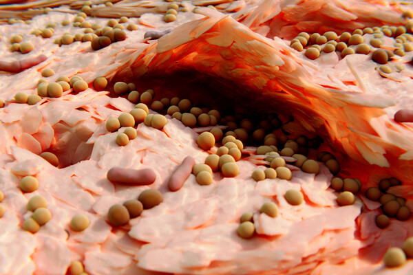 Microscopic view of Staphylococcus aureus.