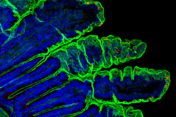 Fluorescent microscopic images shows a section of intestine with blue, green, and red labels.