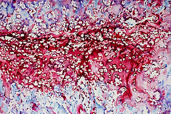watercolor image depicting the embryonic bone development process, endochondral ossification, featuring cartilage and bone.