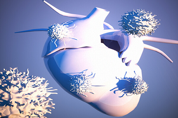 Rendering of tumors surrounding heart