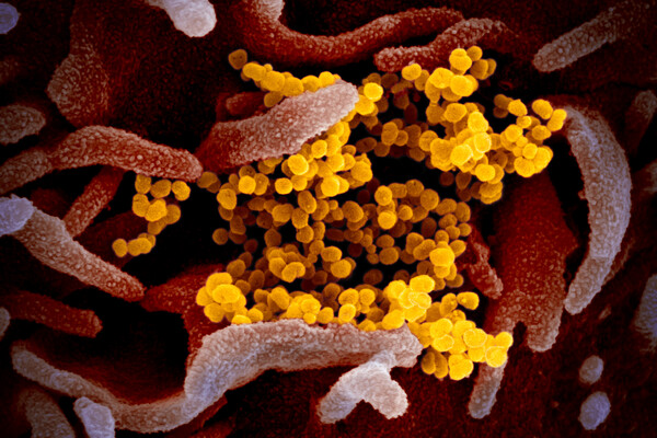 microscopic image of covid-19