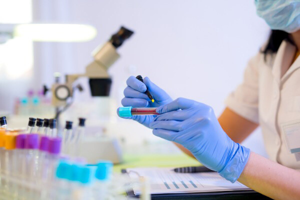 A lab worker wearing latex gloves holds a vial of blood in a lab