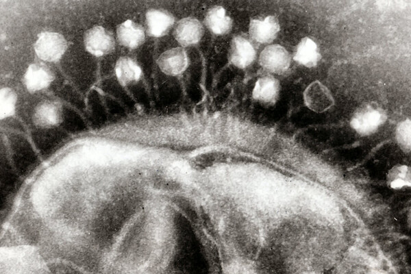 electron micrograph of bacteriophages attached to a bacterial cell