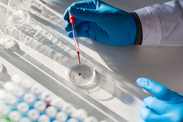 Gloved hand in a lab dropping blood sample from a pipette into a petri dish.