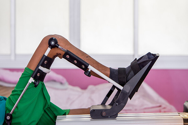 Leg in a continual motion machine following knee surgery