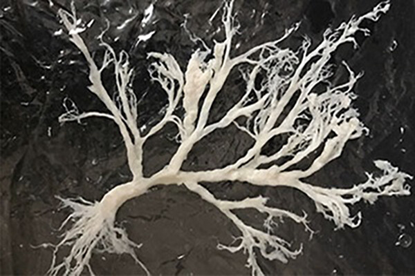 microscopic lung matter