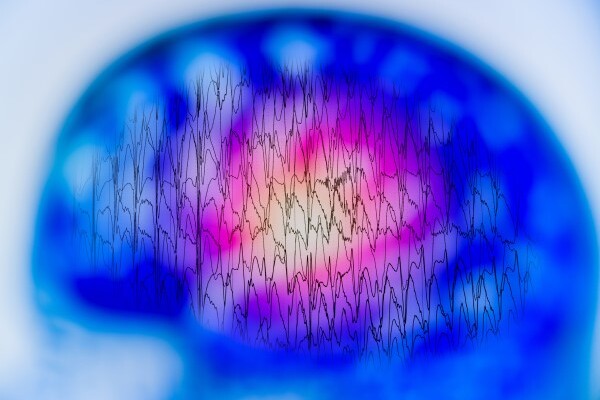 Scan of a brain
