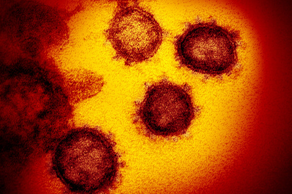 microscopic image of covid-19