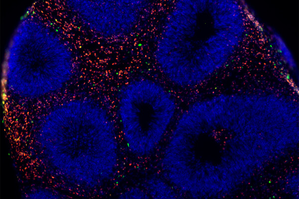 Microscopic view of a brain organoid.