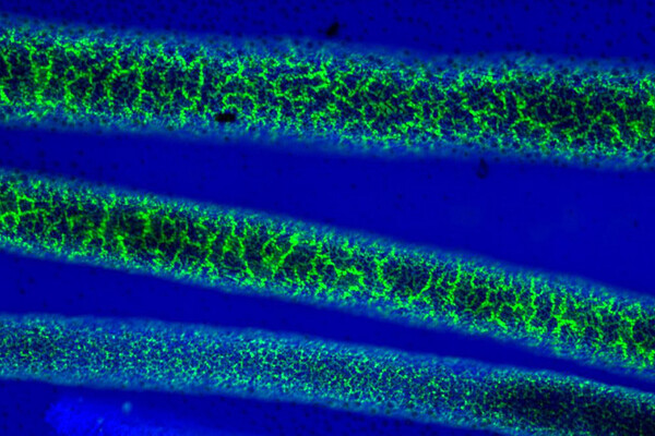 emulsions of oil and water separated by a layer of nanoparticles.