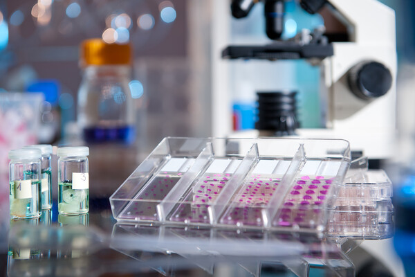 Lab with vials of tissue samples in foreground, microscope in back.