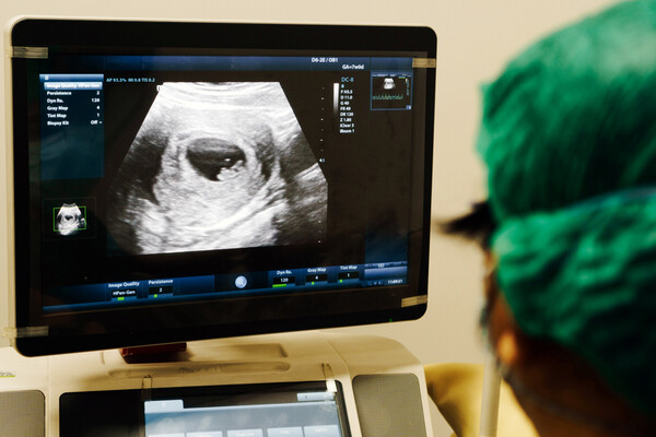 An ultrasound technician looks at an ultrasound on a screen in a hospital.