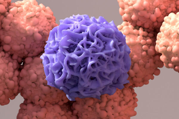 Microscopic view of a macrophage devouring a cancer cell.