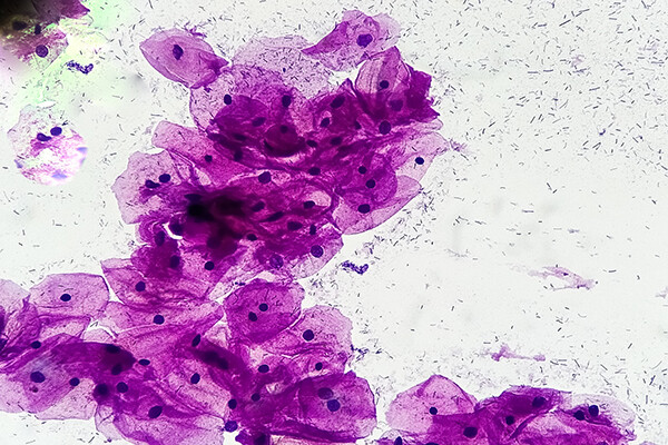 Microscopic view of skin tissue cells.
