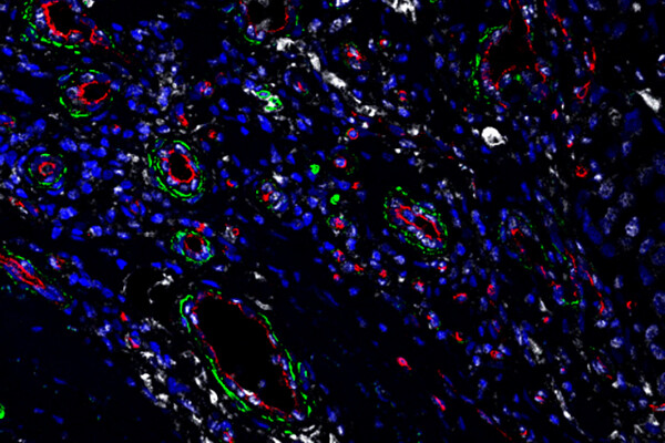 Microscopic view of fibroblasts.