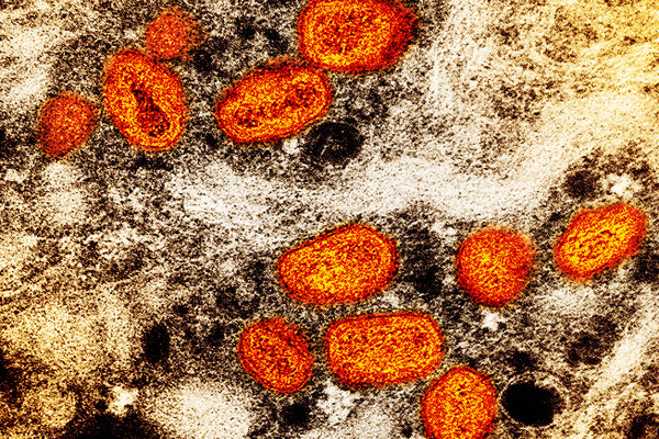 Highlighted monkeypox virus scan
