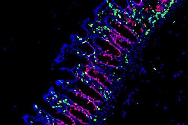 microscopic view of bone marrow 
