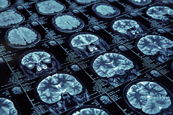 Sheets of brain scans.