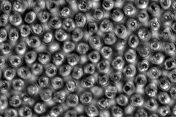 Cryptosporidium.