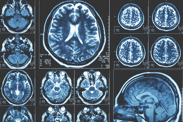 Results of a brain scan.
