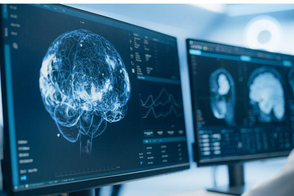 Medical brain scans on  multiple computer screens.
