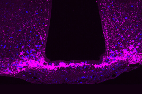 Brain imaging