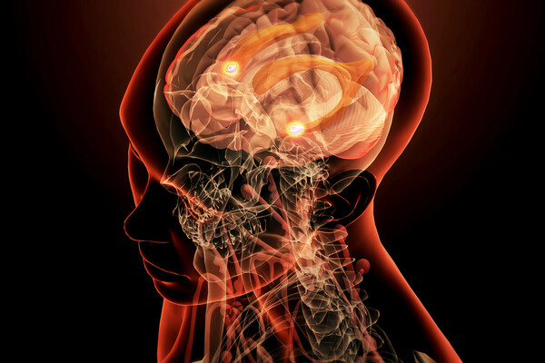 Scan of human amygdala.