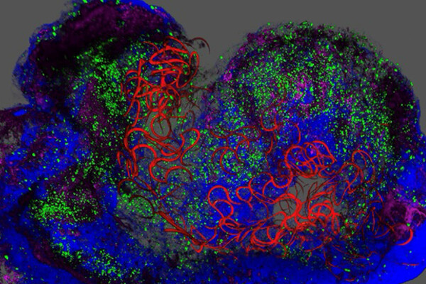 Microscopic view of pancreas tissue.