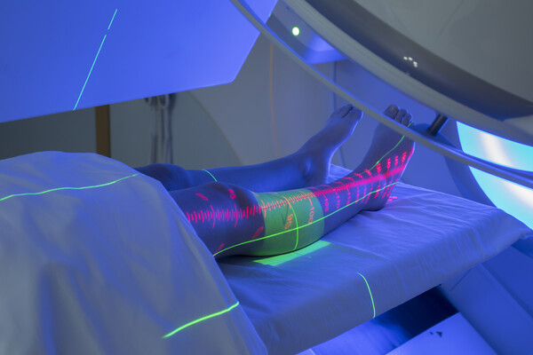 A human leg receiving radiation therapy.