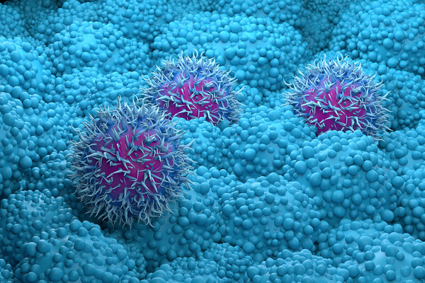 Pancreatic cancer cells.