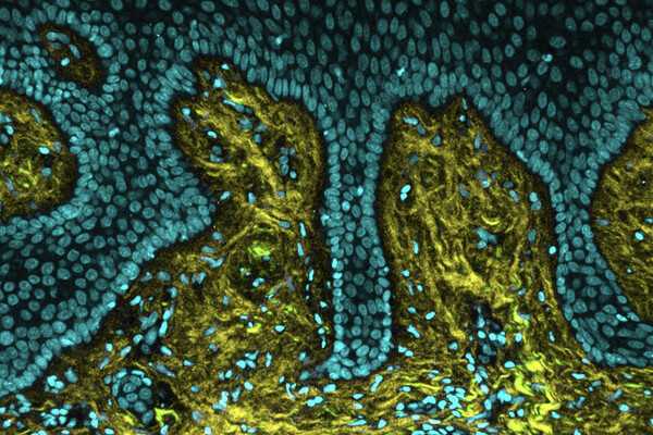 A section of healthy human gum tissue captured using an imaging technique called Second Harmonic Generation microscopy. In this sample, collagen fibers (shown in yellow), which give healthy gums their firm, resilient stiffness, are dense and well-organized—acting as a supportive scaffold for the surrounding cells (shown in teal).