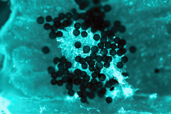 Microrobots swarming fungal biofilms.