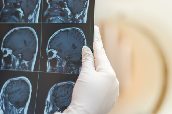  Gloved hand holding a scan of four brains