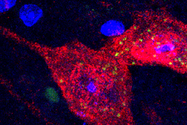 Microscopic view of mRNA