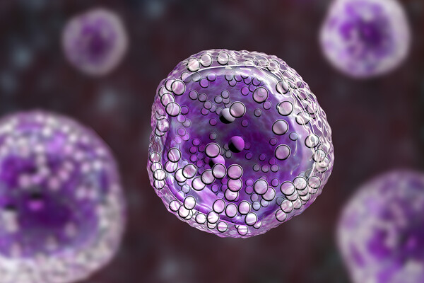 A lymphoma cell
